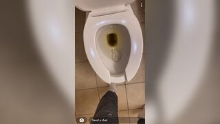 Teen girl shows her poop
