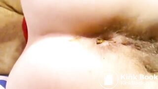 Hot mature dirty anal