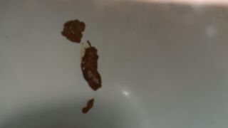 Morning Diarrhea