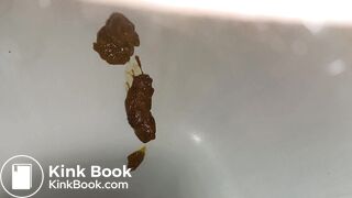 Morning Diarrhea