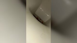 Diarrheaaa