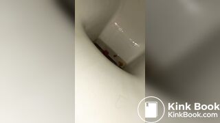 Diarrheaaa