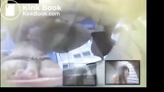 swimsuit diarrhea - video 2