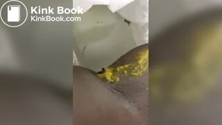 Ebony toilet diarrhea