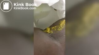 Ebony toilet diarrhea