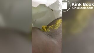 Ebony toilet diarrhea