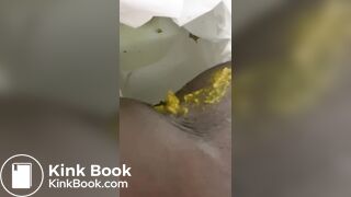 Ebony toilet diarrhea