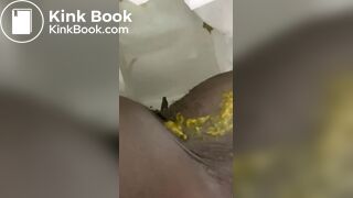 Ebony toilet diarrhea