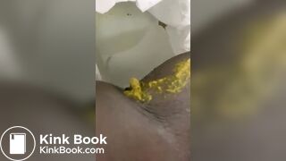 Ebony toilet diarrhea
