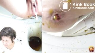 women has a liquid diarrhea