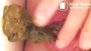 Prolapse Pro (Closeup)