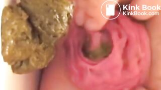 Prolapse Pro (Closeup)