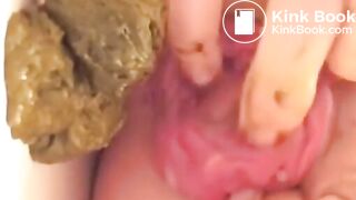 Prolapse Pro (Closeup)