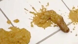 Shit spewing bumhole 2