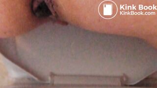 My butthole giving birth to poo