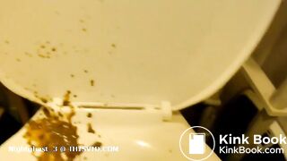 Laxative induced diarrhea