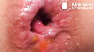 Constipation Japanese Compilation