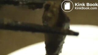 C*U*N-001] Post Feces Diary Post Scat