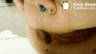 Bumhole oozing shit