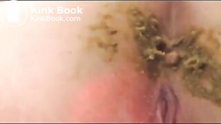 Fat Ass Housewife show her dirty Asshole