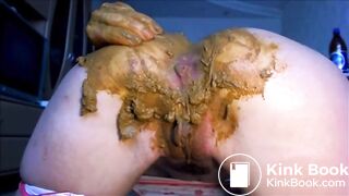 Anal prolapse after fisting her ass