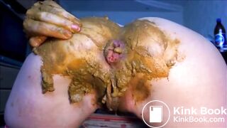 Anal prolapse after fisting her ass