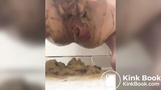 prolapse and shit 39