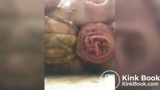 prolapse and shit 39