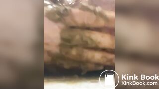 prolapse and shit 39