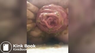 prolapse and shit 39