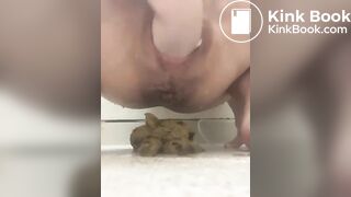 prolapse and shit 39