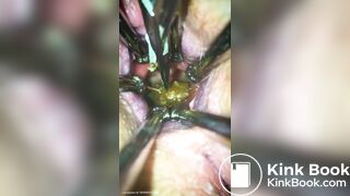 Anal play - video 30