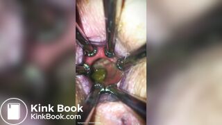 Anal play - video 30