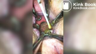 Anal play - video 30