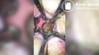 Anal play - video 30