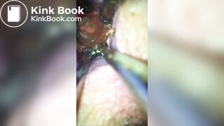 Anal play - video 30