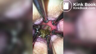 Anal play - video 30