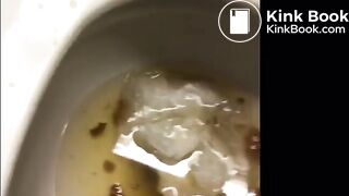 Loose shitting ebony - video 2