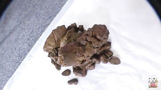 Hard constipated poop - video 2