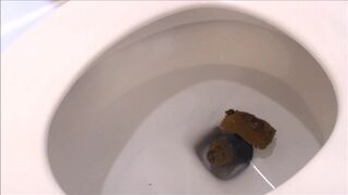 Prolapsed Pooping Arse Compilation
