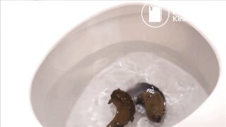 Prolapsed Pooping Arse Compilation