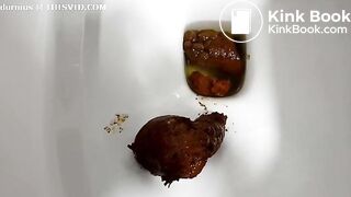 Scat1179