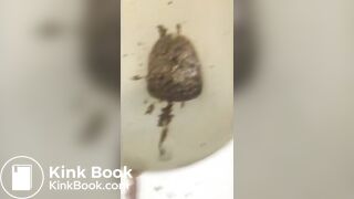 Melissa has diarrhea in a public toilet