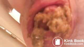 PROLAPSE AND SHIT 34