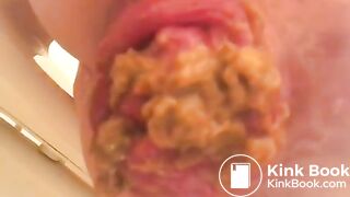 PROLAPSE AND SHIT 34