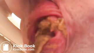 PROLAPSE AND SHIT 34