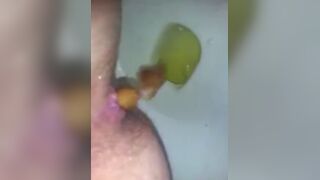Diarrhea - video 54