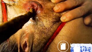 Crotchless panties scat play