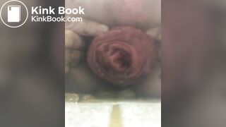 prolapse and shit 32