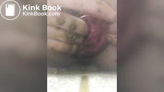prolapse and shit 32
